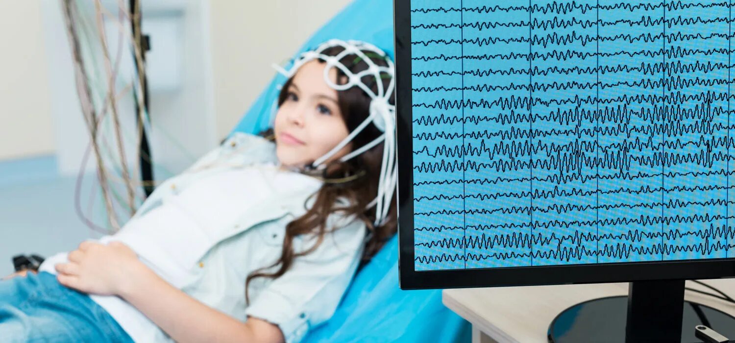 Плохое ээг. Электроэнцефалограф neurofax eeg-1100 k. электроэнцефалография головного мозга (ээг). рэг и ээг. транскраниальная электроэнцефалограмма.