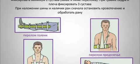 Правила наложения шины при переломе бедра