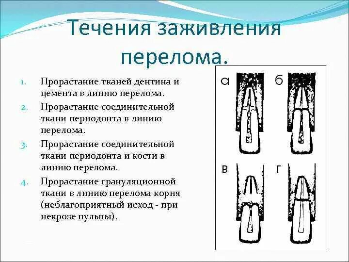 Через сколько заживает перелом. Процесс заживления перелома. Условия необходимые для заживления перелома.