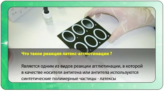Латекс агглютинация микробиология. Метод латекс агглютинации. Реакция латекс агглютинации механизм. Метод латекс агглютинации. Метод латекс агглютинации.