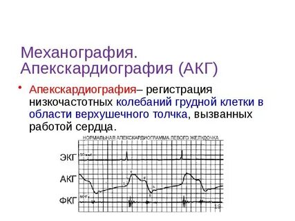 Механография это