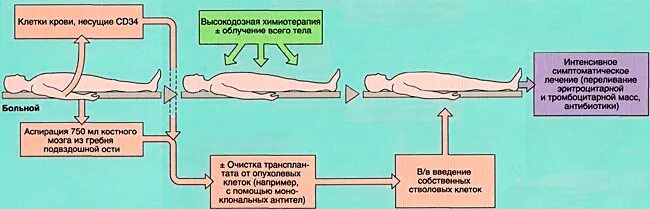 Как пересадить мозги