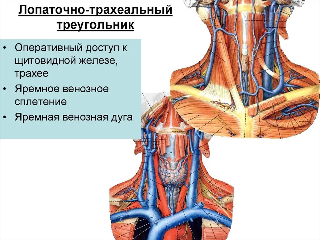 Яремная артерия где находится. Внутренняя яремная Вена анатомия кт. Лопаточно трахеальный треугольник шеи. Подключичная Вена анатомия. Передняя яремная Вена анатомия схема.