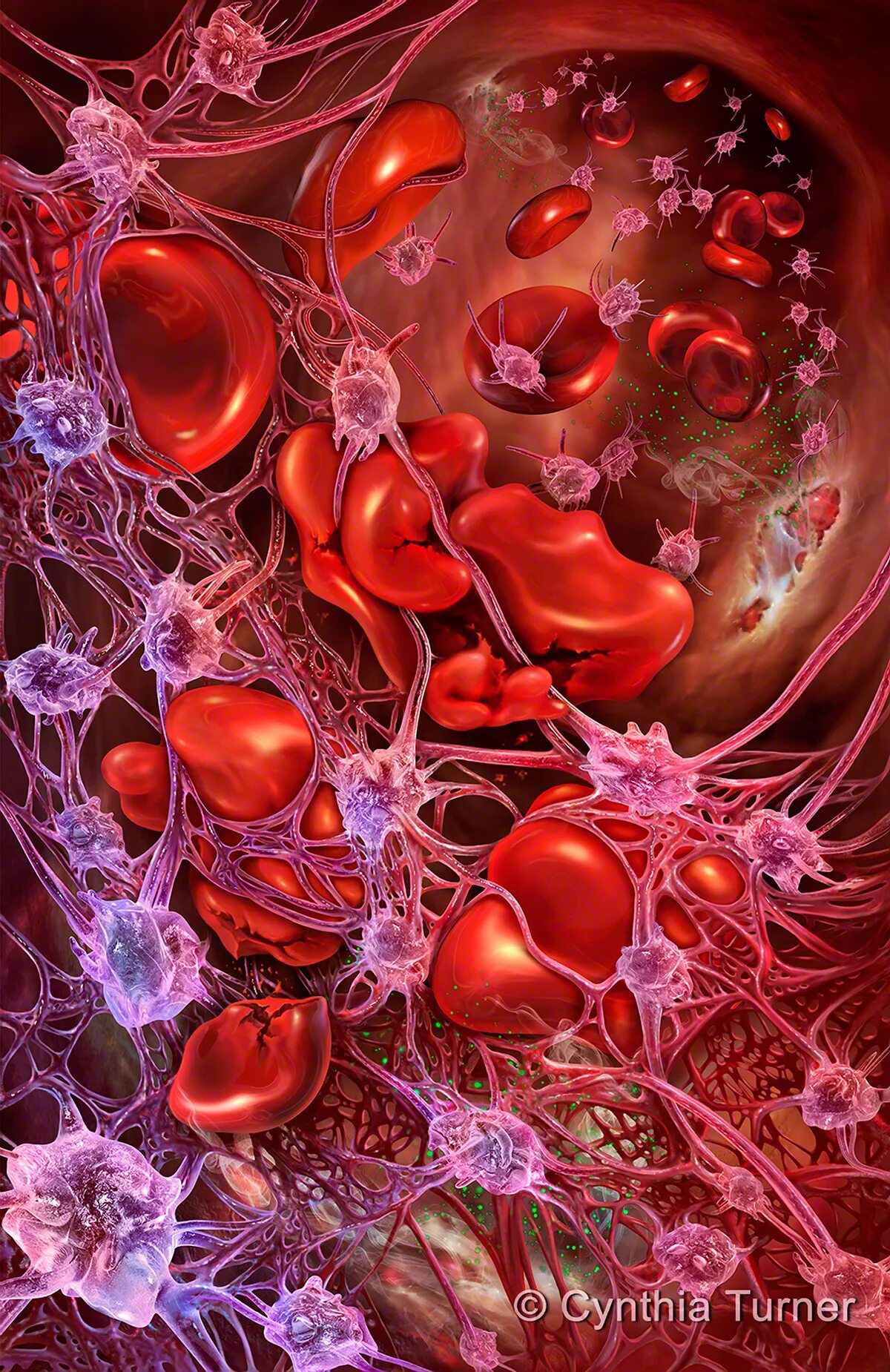 Гематология. Кровь гематология. Гематология исследования. Железодефицитная анемия гемоглобин. Гематология бесплатные.