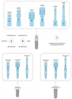 Импланты lenmiriot отзывы