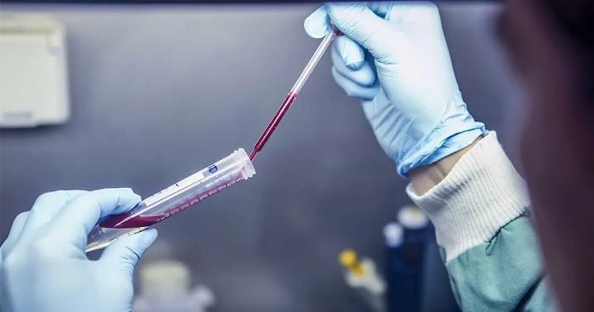 Исследование крови. Clinical Blood Test. Искусственно синтезированная кровь. Исследование крови для презентации.