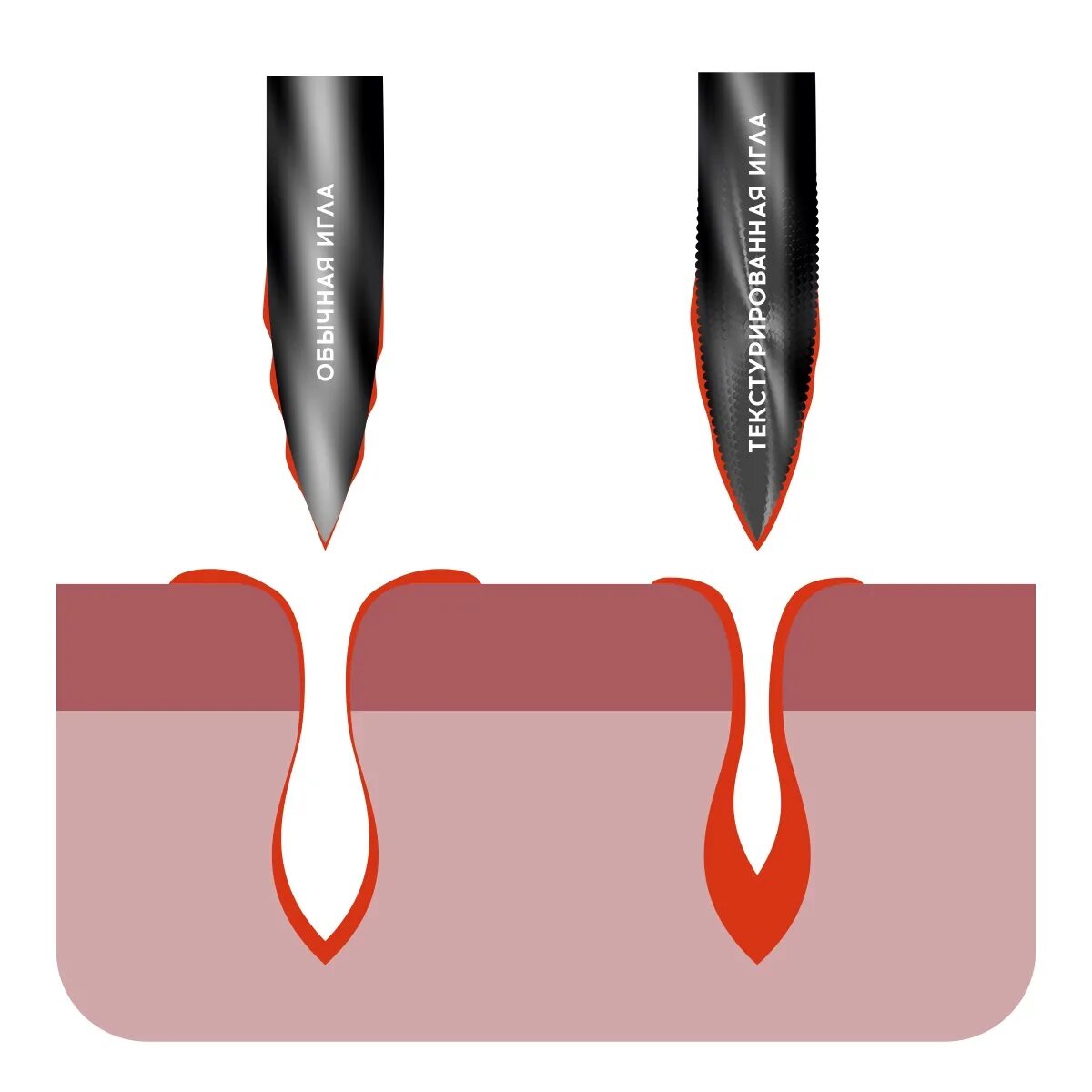 Игл пример. Игла инъекционная 32 g. Игла round 5r. Игл пример. Типы хирургических игл.