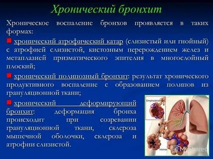 Бронхит что это