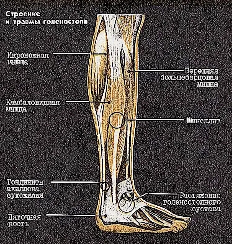 Почему болит кость ноги спереди. Боль в большой берцовой кости на ноге спереди. Боль в большеберцовой кости сбоку. Травма надкостницы голени. Боль в кости нога спереди голень.