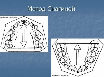 Метод тона