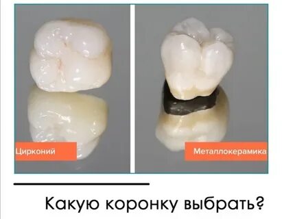 Что лучше металлокерамика или диоксид циркония коронки