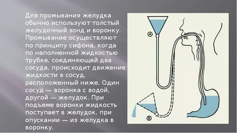 Показания к промыванию желудка. Зондовое промывание кишечника алгоритм. Зондовое промывание желудка. Зондовое промывание желудка назогастральный зонд. Алгоритм беззондового промывания желудка.