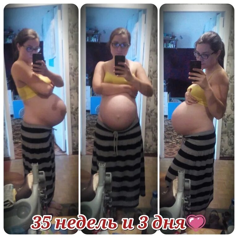 Живот с двойней по неделям. Живот с двойней на 36 неделе беременности. Живот по месяцам беременности с двойней. Живот по неделям беременности двойней. Роды 36 беременность форум