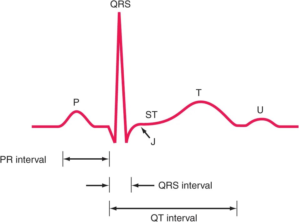 Электрокардиограмма QRS. Комплекс QRS на ЭКГ. Патологический комплекс QRS на ЭКГ. Комплекс QRS норма.