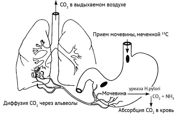 13c дыхательный тест. 13с-уреазный дыхательный тест. 13с-уреазный дыхательный тест подготовка. Дыхательный уреазный тест с мочевиной с13. Неинвазивные тесты для определения Helicobacter pylori дыхательный.