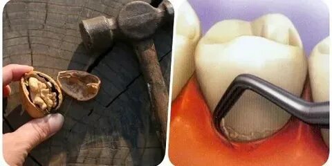High stone как удалить