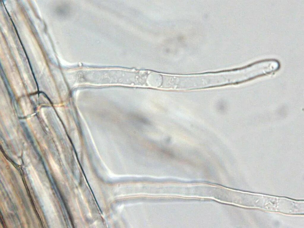 Микрофотография среза корень. Корневые волоски микропрепарат. Клетки растения корневые волоски. Корневой чехлик и корневые волоски под микроскопом. Корневыевоооски под микроскопом.