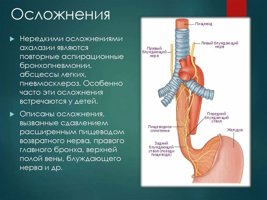 Левый блуждающий нерв. Правый блуждающий нерв и пищевод. блуждающий нерв и пищевод. нервы пищевода. кровоснабжение пищевода.