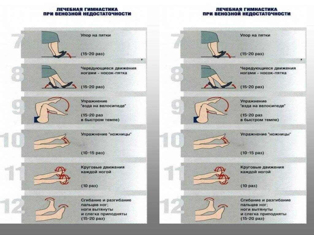 Упражнения лфк ног. Упражнения для ног при тромбозе глубоких вен нижних конечностей. Лечебная физкультура после операции флебэктомии. Упражнения лечебной физкультуры после флебэктомии. ЛФК при тромбофлебите комплекс упражнений.