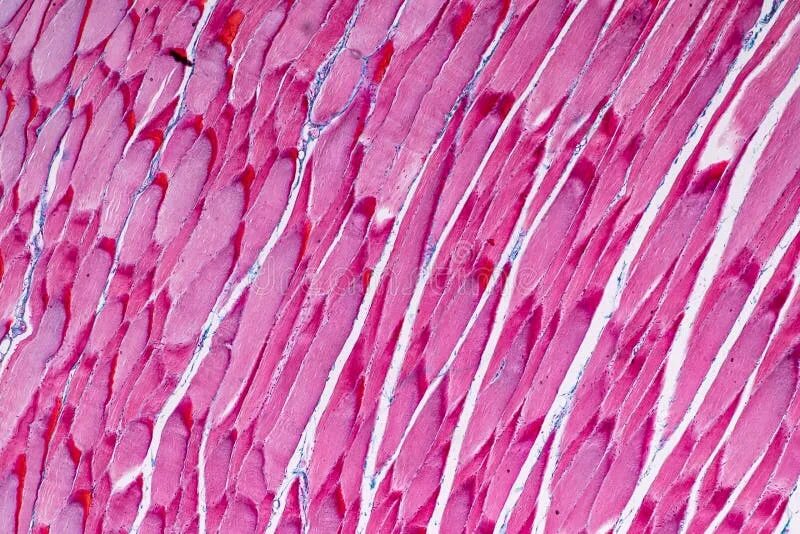 Striated skeletal muscle Tissue. Мышцы под микроскопом. Скелетные мышцы под микроскопом. Мышечная ткань под микроскопом. Гладкая мышечная ткань в дерме