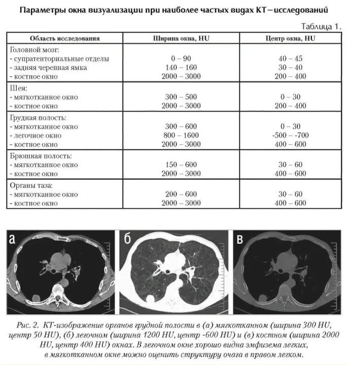 Шкала Хаунсфилда при компьютерной томографии таблица. Окна исследования кт. Плотность на кт. Плотности различных тканей на кт.