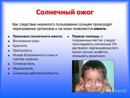 Чтобы загорая не получить ожоги