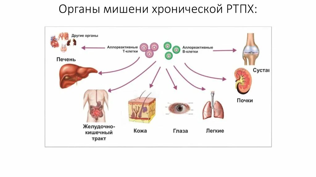 5 органы мишени. Реакция трансплантат против хозяина схема. РТПХ (реакция трансплантат против хозяина)..