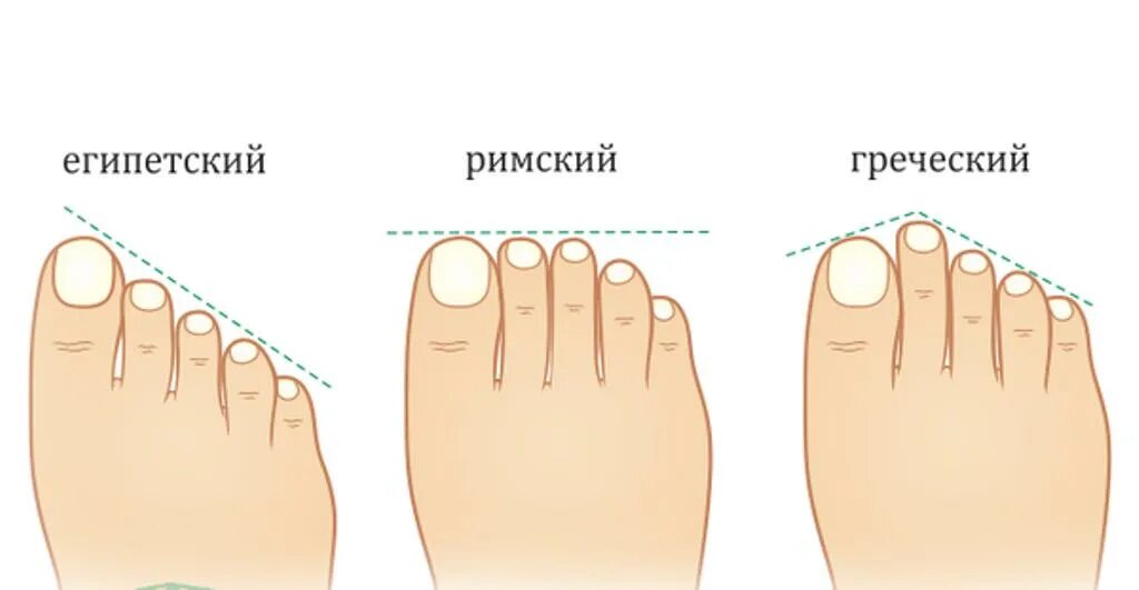 Форма стопы Египетская Греческая. Форма стопы Римская Греческая. Греческая стопа Римская Египетская стопа. Форма пальцев на ногах. 3 типа стопы