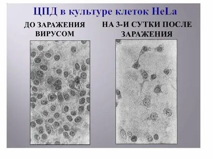 Культура вируса 5