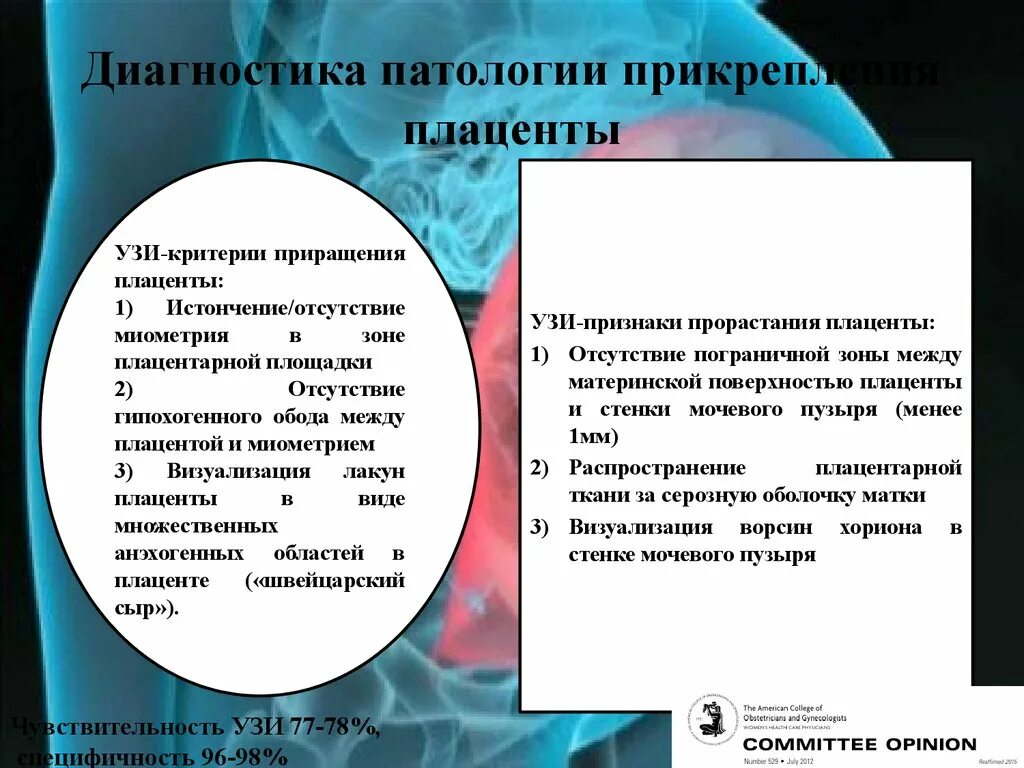 Истинное приращение. Патология прикрепления плаценты. Диагностика аномалий прикрепления плаценты. Истинное приращение плаценты. Вращение плаценты причины.