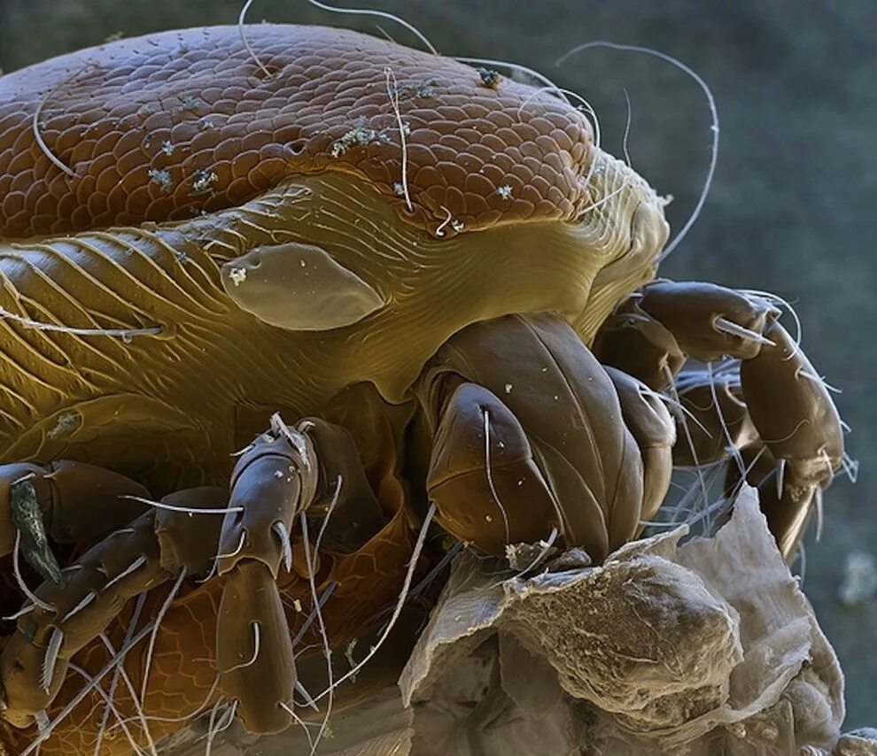 Сон под микроскопом. Клещ dermatophagoides pteronyssinus, farinae. клещ dermatophagoides farinae. сапрофиты бельевые клещи. клещ сапрофит под микроскопом.