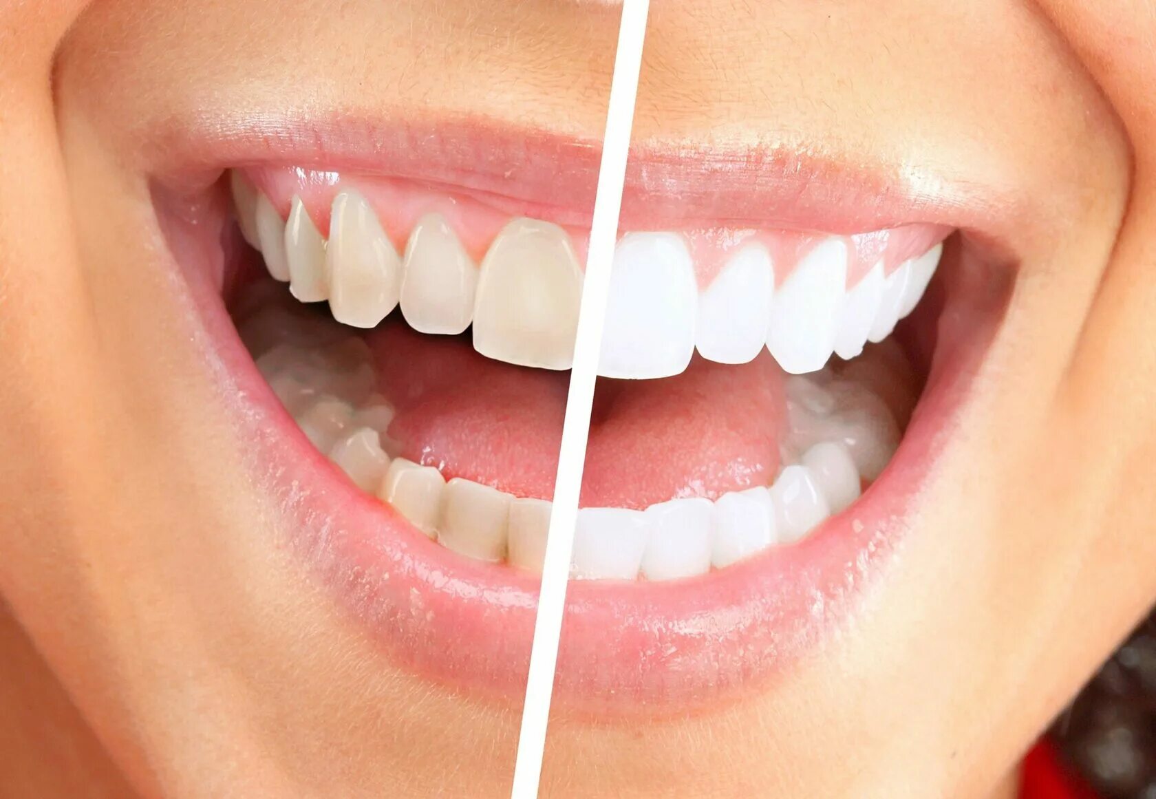 Как получить smile