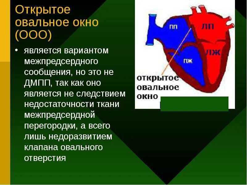 Функционирующее овальное. Сердца ВПС открытое овальное окно. Врожденный порок сердца открытое овальное окно. Овальная ямка межпредсердной перегородки. Открытое овал.ное окно.