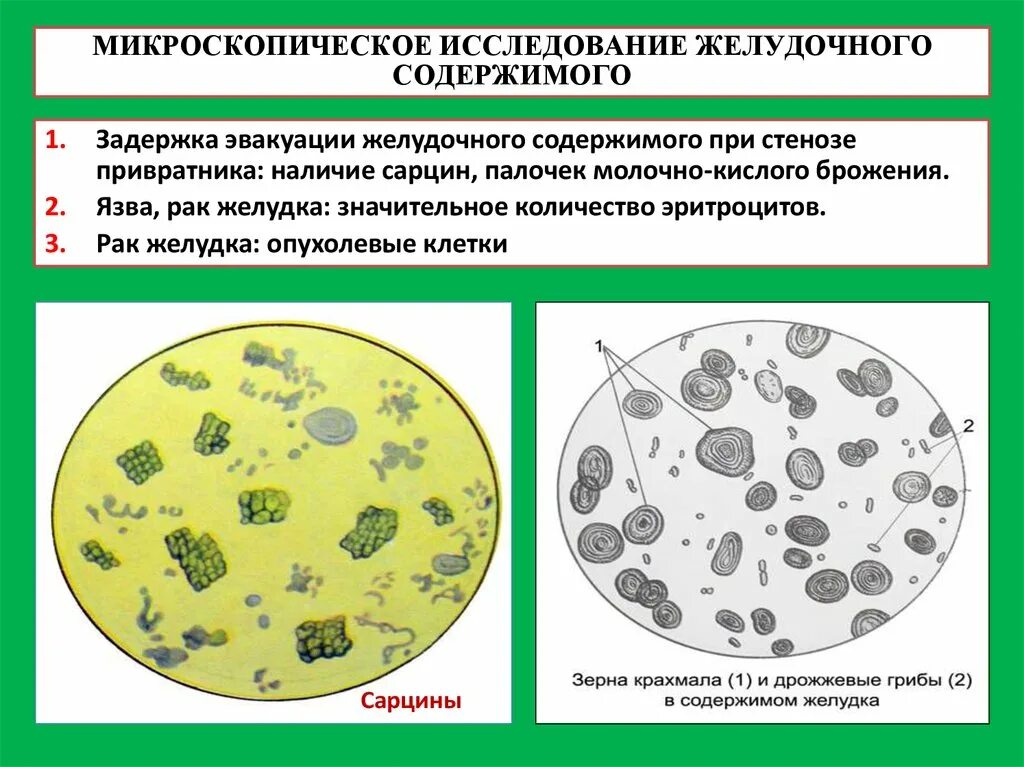 Простейшие при микроскопии дуоденального содержимого. Микроскопическая картина дуоденального содержимого. Желудочное содержимое микроскопия. Микроскопическое исследование желудочного содержимого.