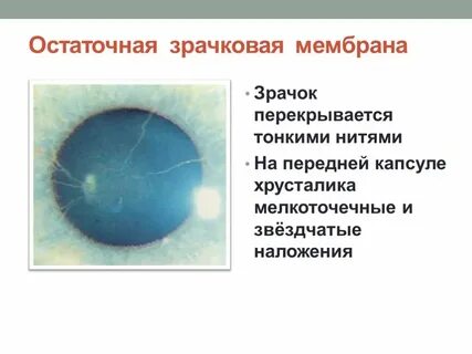 Остатки мембраны