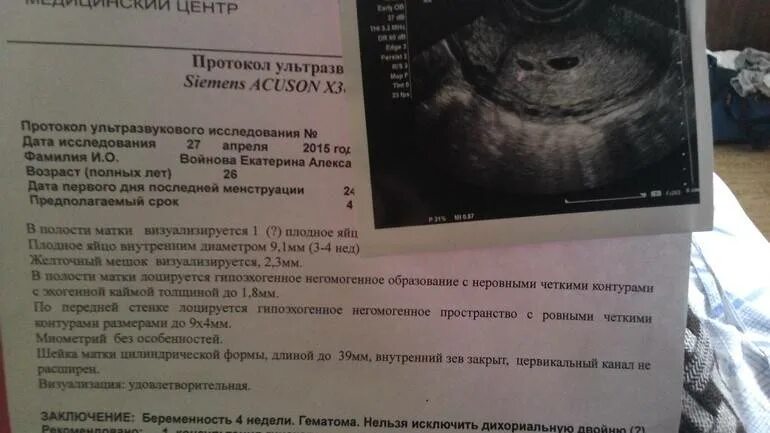 Записаться на узи на ранних сроках. Узи 3-5 недели беременности. узи беременности на ранних сроках. узи 2-3 недели беременности. ультразвуковое исследование при беременности раннего срока.