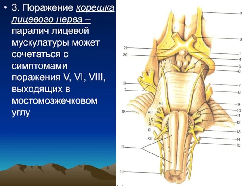 Корешки черепных нервов. Поражение корешка лицевого нерва. Лицевой нерв мостомозжечковый угол поражение. Поражение лицевого нерва в мостомозжечковом углу.