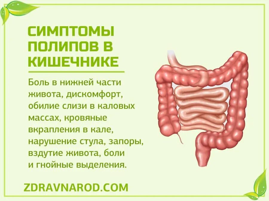 Спазм кишечника симптомы и лечение. Полип кишечника прямой кишки. полипы в кишечнике симптомы. полипы толстого кишечника.