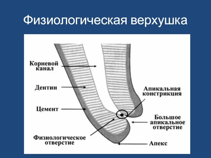 Определение корневых каналов. Анатомическая и физиологическая верхушка корня зуба. Физиологическая верхушка корня зуба. Анатомическая физиологическая и рентгенологическая верхушки корня. Апикальное отверстие зуба.