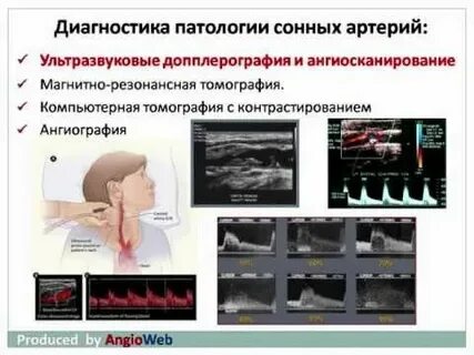 Отзывы операции сонной