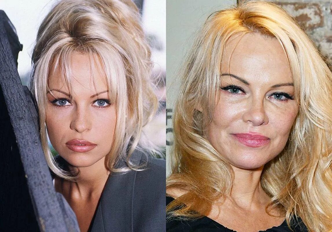 Рене зеллвегер после операции. Актрисы после пластической операции. Актрисы после пластической операции. Актрисы после пластической операции. Звезды до пластики.