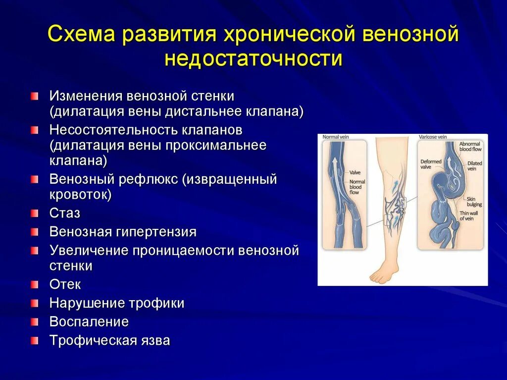 Синдром хронической венозной недостаточности. Классификация ХВН нижних конечностей. Хроническая венозная недостаточность с1. Хроническая венозная недостаточность нижних конечностей. Что значит расширение вен