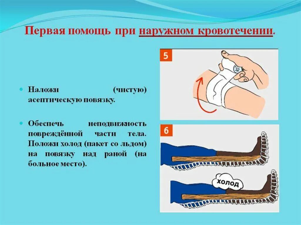 Этапы последовательности оказания первой помощи. Алгоритм оказания первой помощи при наружном кровотечении. Последовательные этапы первой помощи при наружном кровотечении. Памятка оказания первой помощи при наружном кровотечении. Хтапы первой помощи при наруном кровотечение.