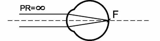 Физиологическая оптика. Эмметропия рефракция. Дальнейшая точка ясного видения. Ближайшая точка ясного видения при гиперметропии. Эмметропия глаза что это такое.