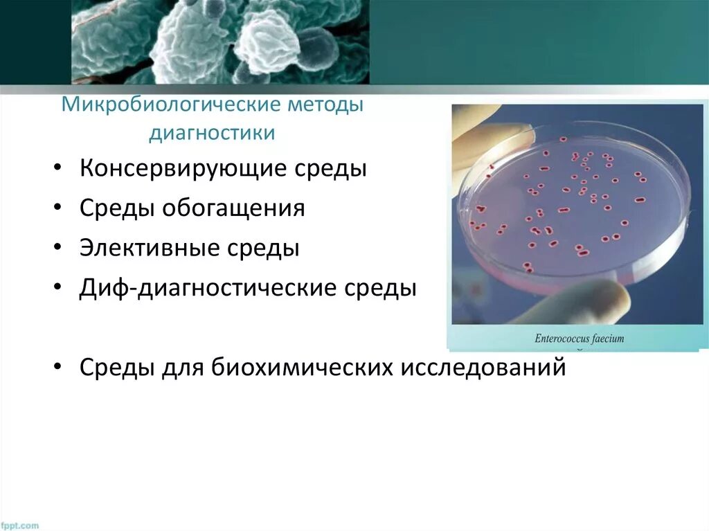 Методы исследования микроорганизмов. Методы микробиологической диагностики. Методы исследования в микробиологии. Методы диагностики бактерий. 2 этап бактериологического метода