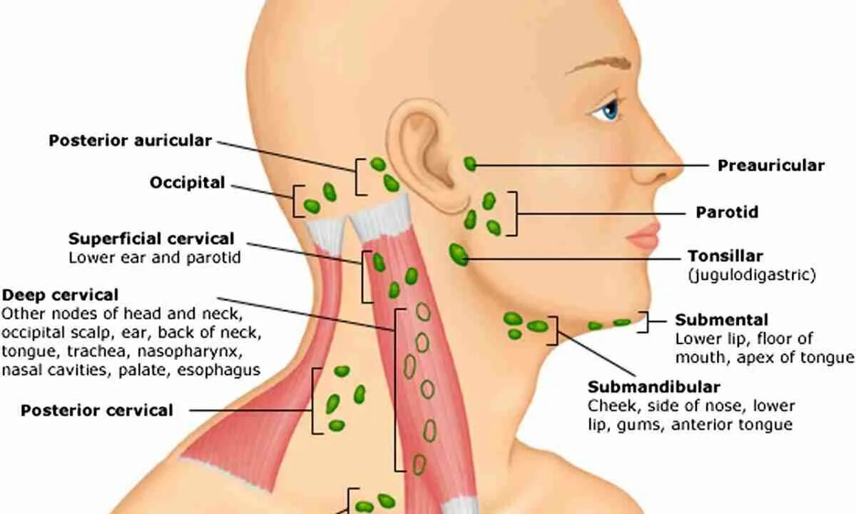 Схема подчелюстных лимфоузлов. Воспалился подчелюстной лимфоузел лимфоузлы. Подчелюстные лимфатические узлы схема. Подчелюстные лимфоузлы схема. Подвздошная лимфаденопатия