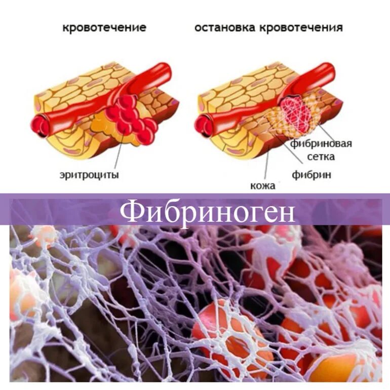 Белок тромба. Фибрин и фибриноген. Белок фибрин.