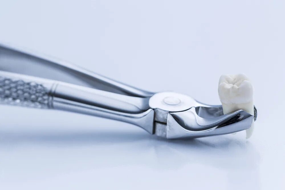 Tooth extraction