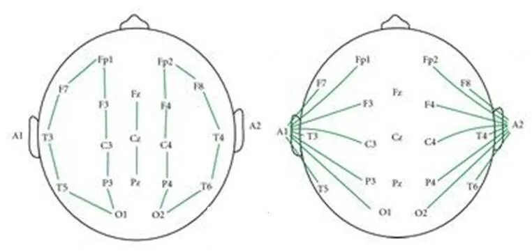 Водительский ээг. ЭЭГ-модифицированная схема наложения электродов. Мобильный портативный электроэнцефалограф. Клеммы ушные для ЭЭГ. ЭЭГ картинки.