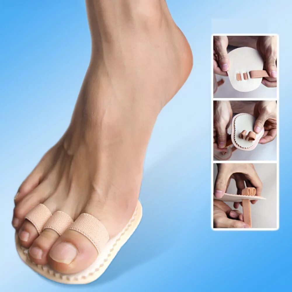 Коррекция деформаций стопы. Hallux valgus корректор. выпрямление пальцев на ногах. корректор выпрямитель молоткообразных пальцев стопы.
